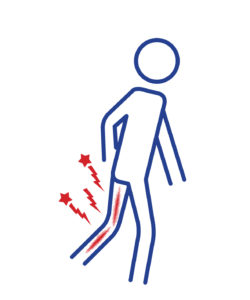 Tidal Health Sciatica